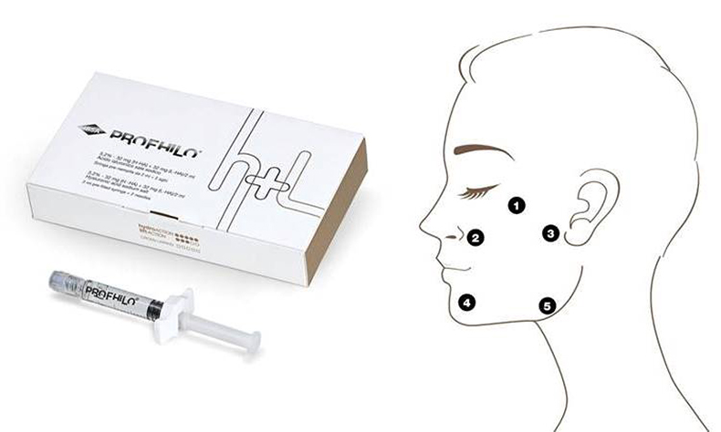 Profhilo packaging and syringe and diagram